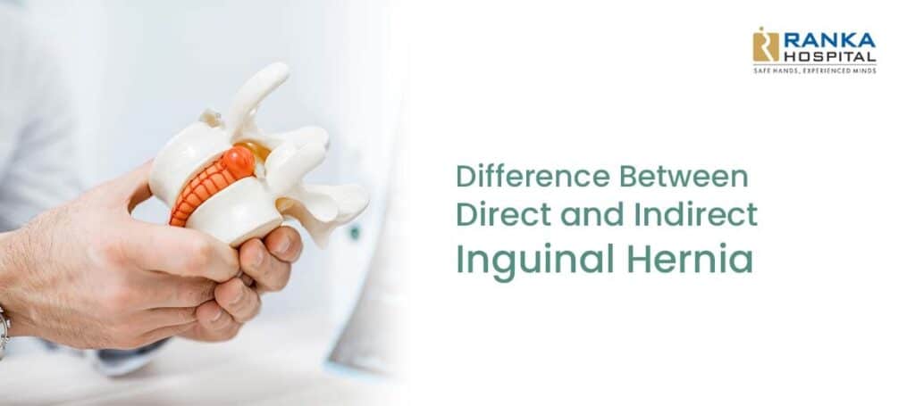 Difference Between Direct And Indirect Inguinal Hernia Ranka Hospital
